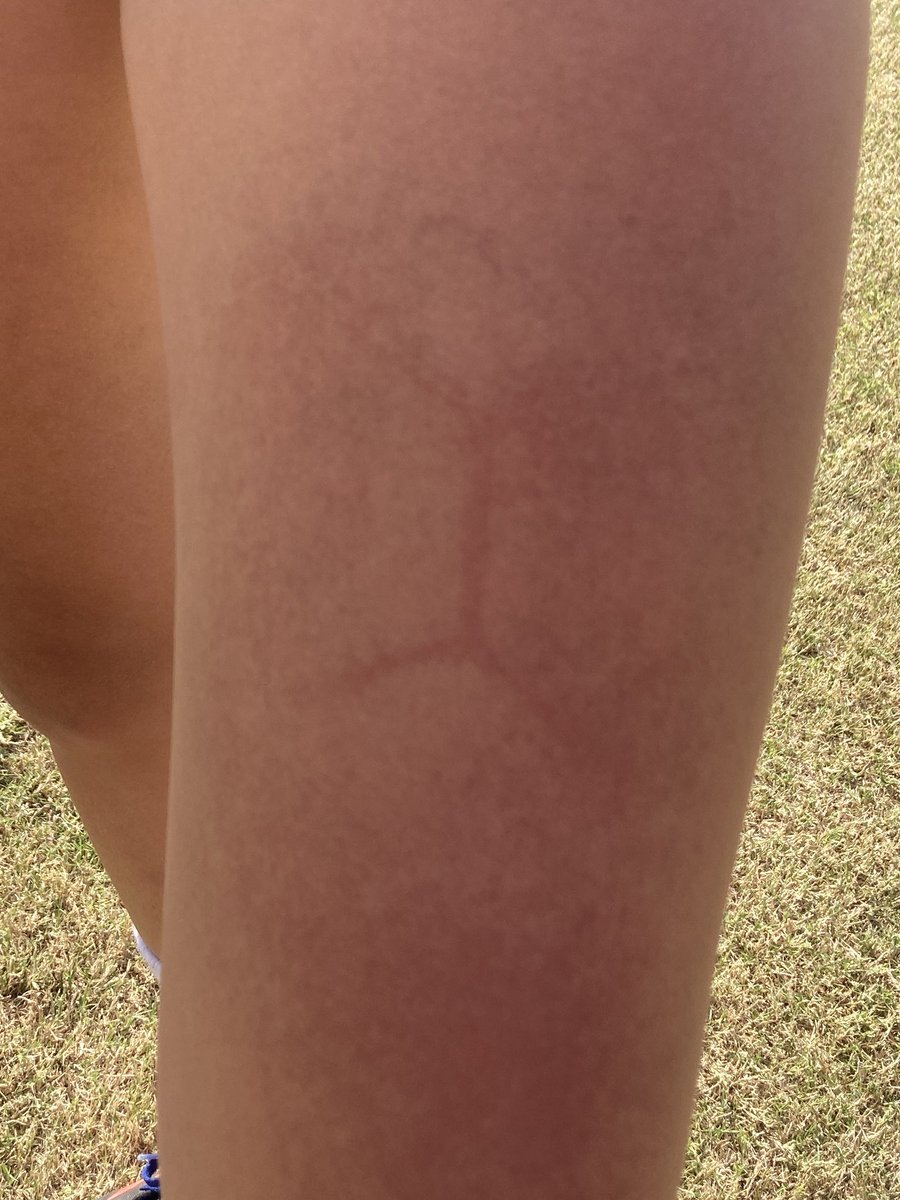 coach_sheldrake's tweet photo. It’s beginning to feel like soccer season! https://t.co/lSbZJOLu0x