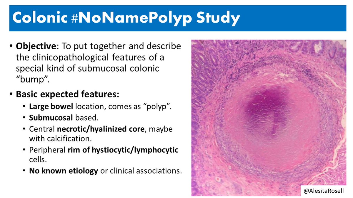 RaulSGonzalezMD's tweet photo. Hey #PathTwitter -- @DraEosina, @PathRuzCaracuel, and I are still working hard to characterize an unusual colon lesion. We call it the #NoNamePolyp study -- check out the pictures! Ever come across one of these? Please contact us and we'll add you to the study! #Pathology #GIPath https://t.co/24EpqlVtpL