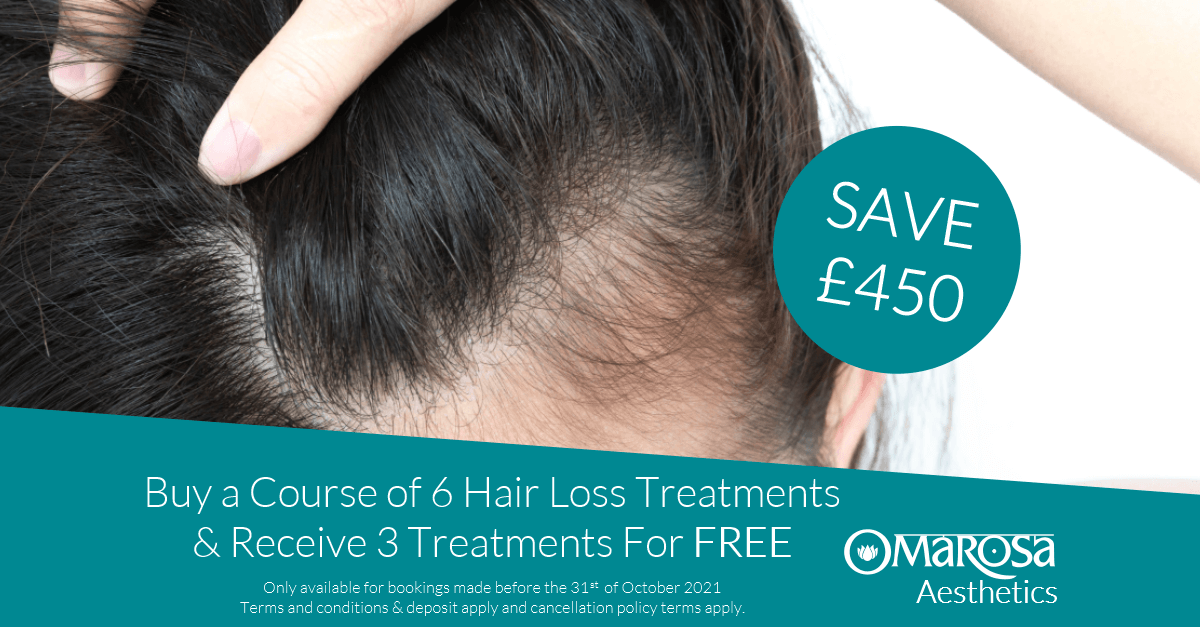 omarosabeauty's tweet photo. Did you know that we provide #HairLoss treatment for men & women?
This month you can save a massive £450 on this advanced treatment using #MPEN and clinically proven serums #SolihullHour
Call us on 0121 745 4288 or visit https://t.co/kbhHGrL8vw
*Valid until 30/09/21 https://t.co/1knQzaoAxk