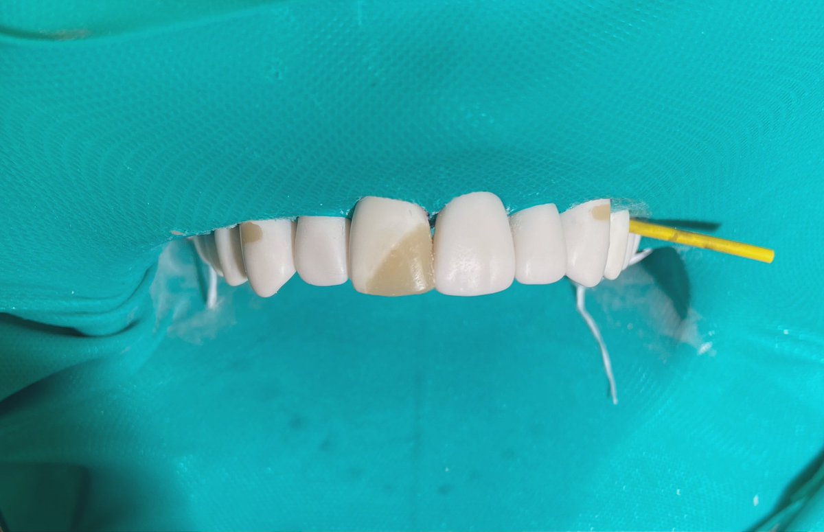 George_2128's tweet photo. If you chip your tooth I got you https://t.co/F0bKcpQlat