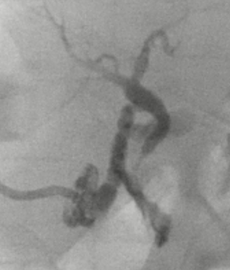 Ravi Srinivasa tweet media