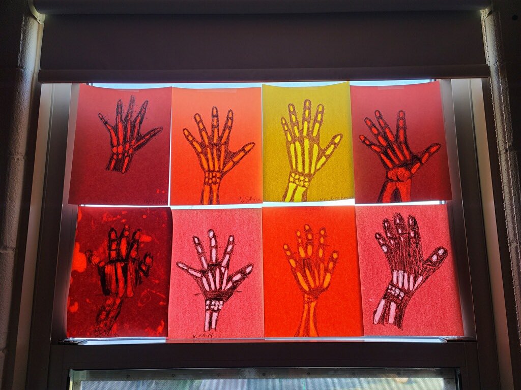 D123Kolmar's tweet photo. How cool are these?! Ms. Sullivan’s scientists made these awesome “x-rays” while learning about bones in Science! @SullivanTeach #d123 #d123kol #scientists https://t.co/ETR6FYSnMq