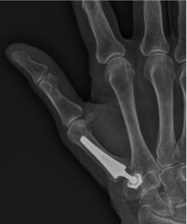 Alistair Jepson tweet media