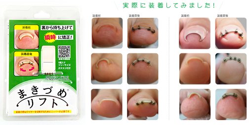 jps_information's tweet photo. 【展示会出展のご案内】
本日最終日（17時まで）！！インテックス大阪「beautyworld JAPAN WEST」に弊社『まきづめリフト』を出展中です👣
【ホール2・N207】JPSブースへ是非お立ち寄りください❤️
#ビューティーワールドジャパン #BWJ #大阪 #まきづめリフト #巻き爪 #巻爪 #フットケア https://t.co/4lOdqalLop
