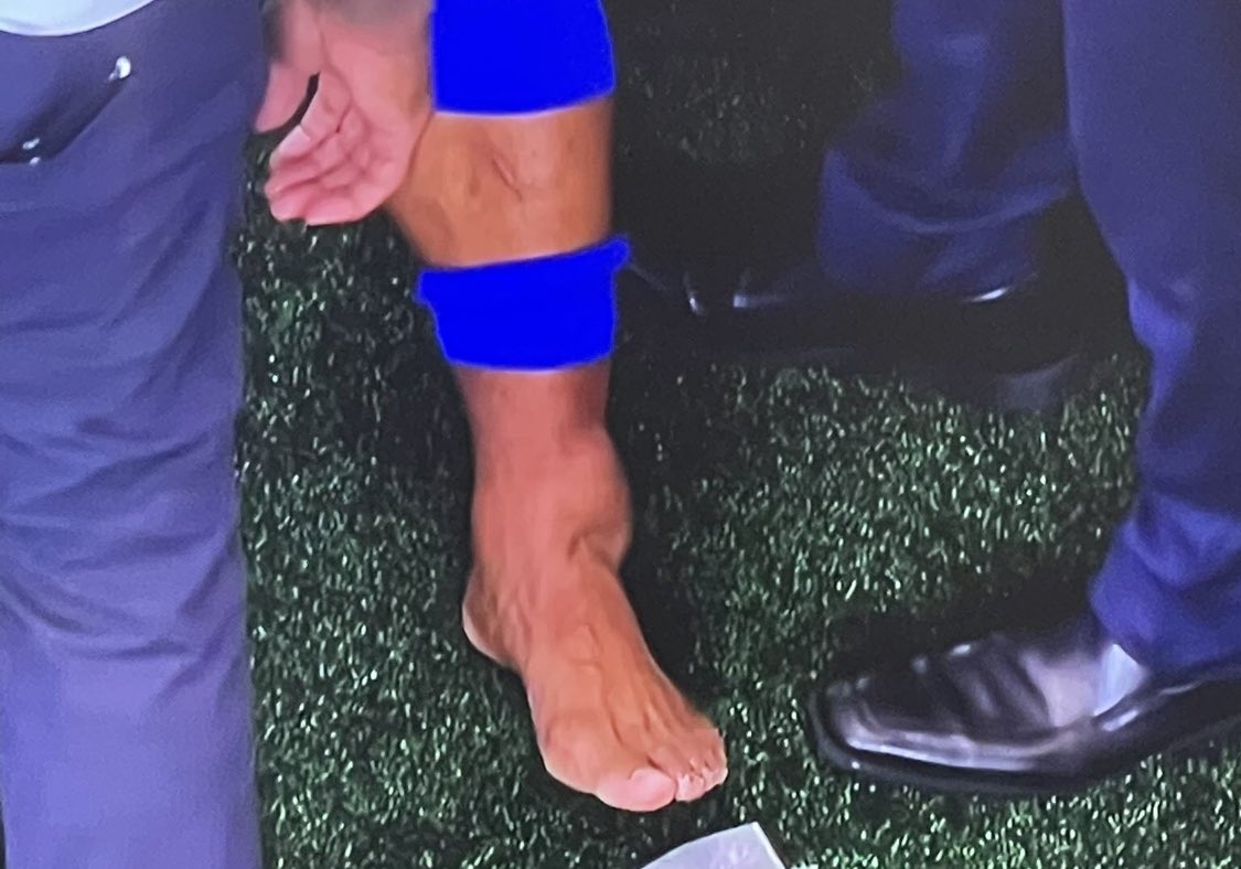 BenRWK's tweet photo. @DuncanSmithNBA Just swollen… https://t.co/TkoZHTbzCb