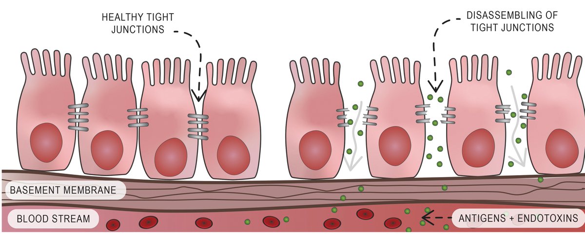The Subjective Well-Being and Health-Related Quality of Life of Australian Adults with Increased Intestinal Permeability and Associations with Treatment Interventions

Read now: ow.ly/ZLC650Gtj4b