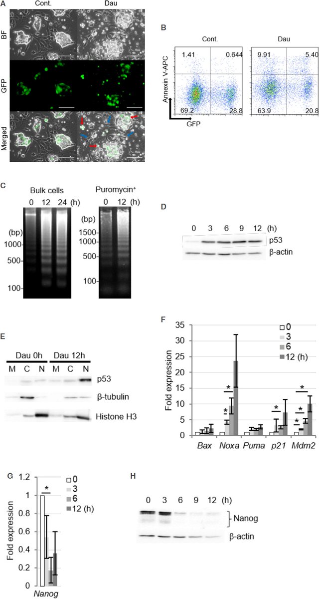 cdrjournal's tweet photo. Welcome to read:🌿*Daunorubicin can eliminate iPS-derived cancer stem cells via ICAD/CAD-independent DNA fragmentation*🌿
👉https://t.co/njxZ6NBNwE
#DNAfragmentation #cancerstemcell 
@agingdoc1 @realBenTalks @gglinskii @kfitzgeraldnd @Dr_Sprggs @Kmorefive @foundmyfitness https://t.co/LsbhOU2kmF