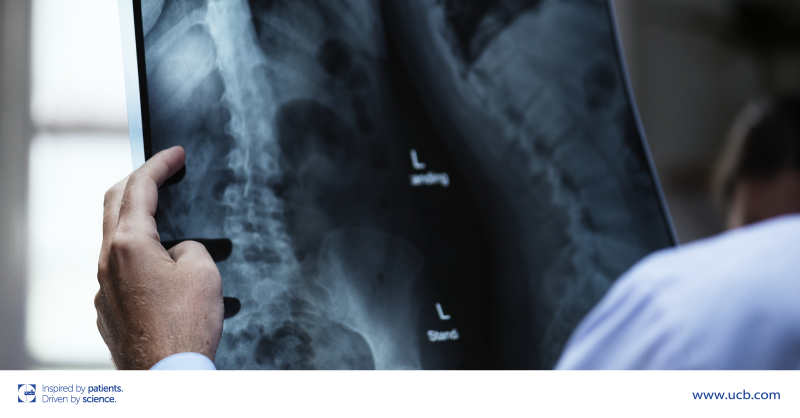 ucb_news's tweet photo. It is estimated that 50% or more of vertebral fractures are currently under-reported. On #WOD2021, #UCB is delighted to announce that ImageBiopsyLab will bring UCB's innovative identification #BoneBot technology to market. Find out more: https://t.co/qXbbF1DwIf