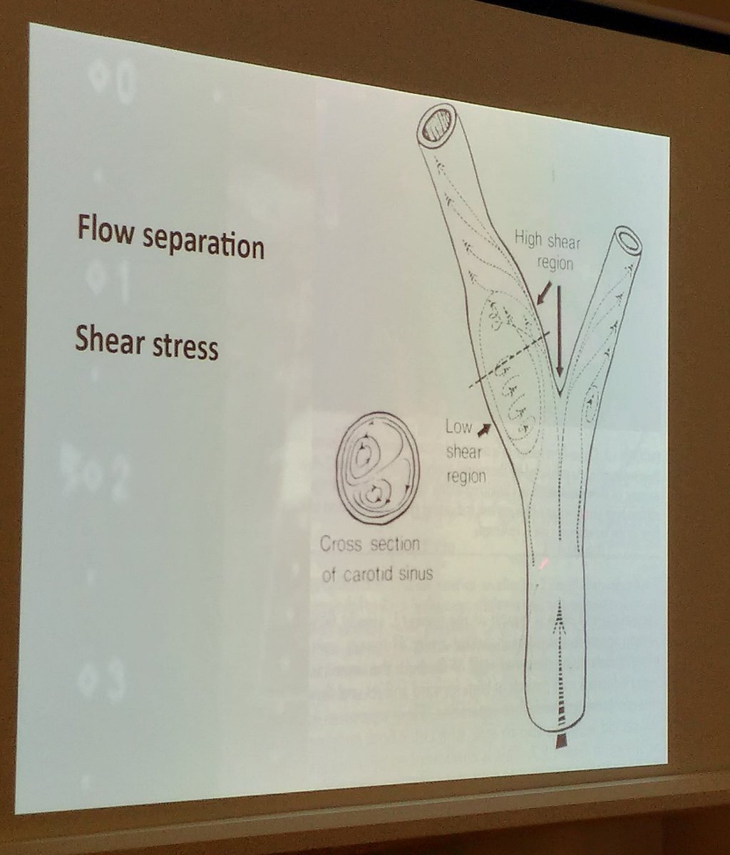 PavelDusek's tweet image. Listening to presentation about laminar and turbulent flow in carotid arteries and its importance in #stroke.
Guess @smartereveryday would love this. Because laminar flow!

#laminarFlow #turbulentFlow