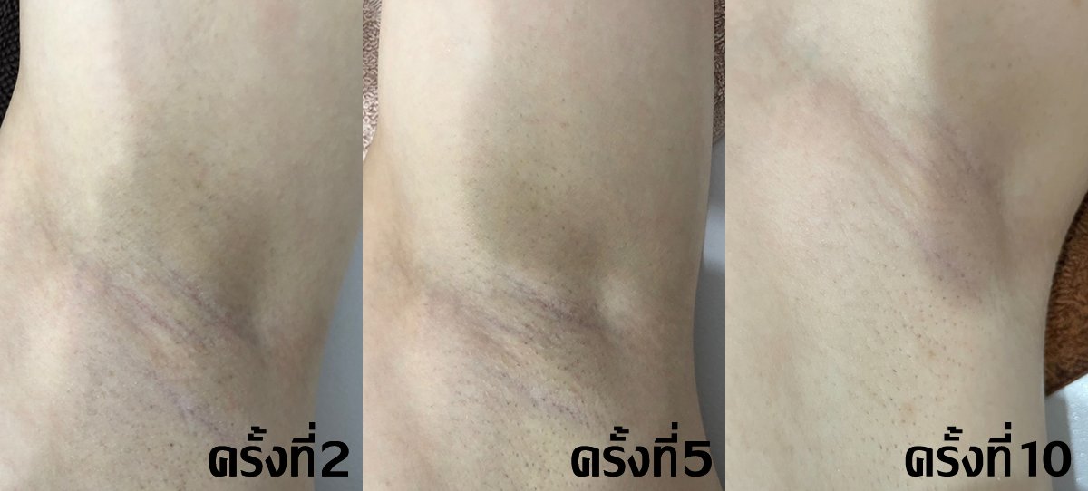 Datsumo Labo Thailand tweet media