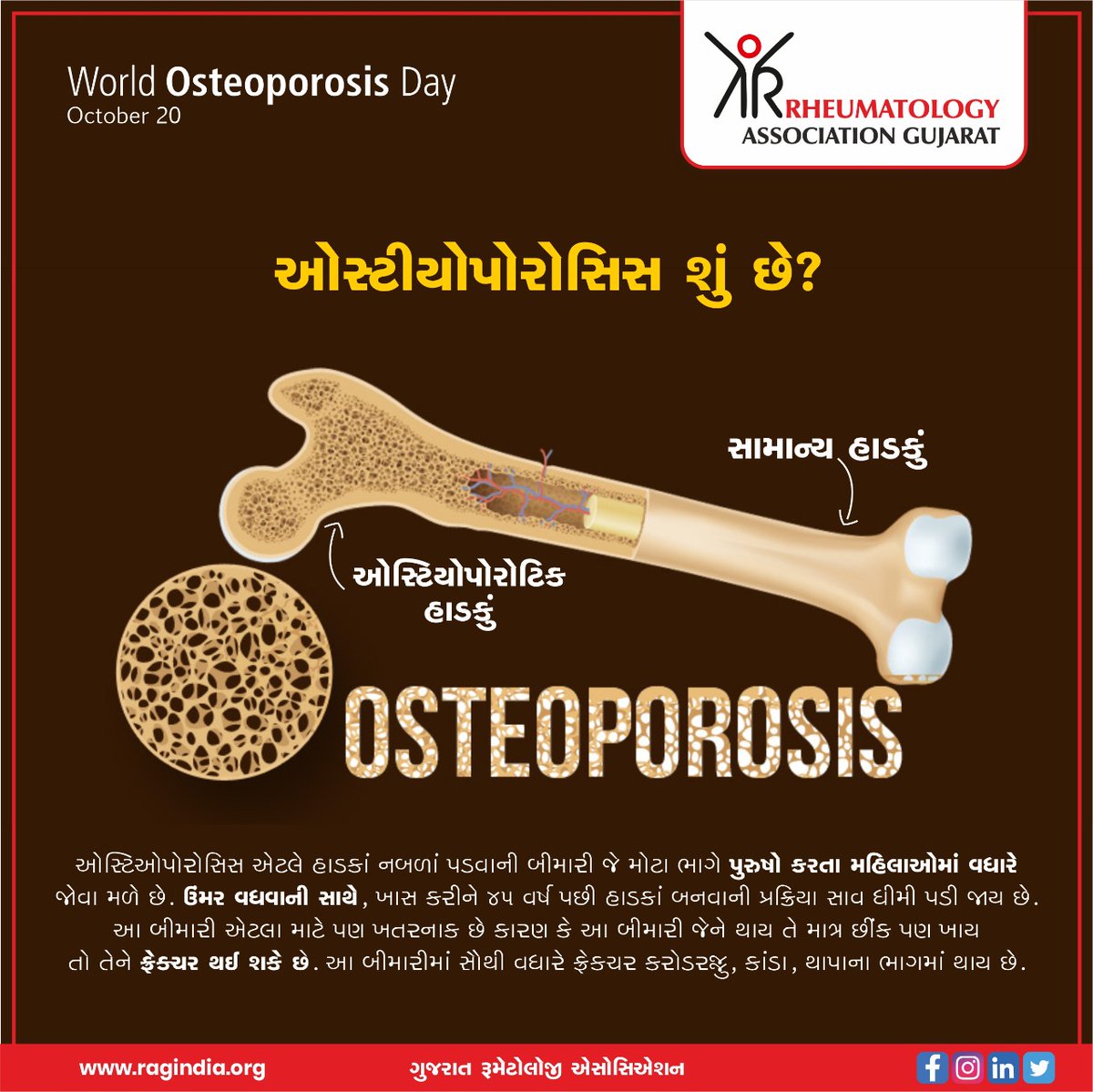 raggujarat's tweet photo. On the occasion of #WorldOsteoporosisDay, let'come together to raise awareness about the disease.

To know more: https://t.co/u9U1bOyZyX

#RAG #Rheumatologist #Rheumatology #JointPain #Osteoporosis #weakbones #jointhealth https://t.co/yf9o0A4HDC