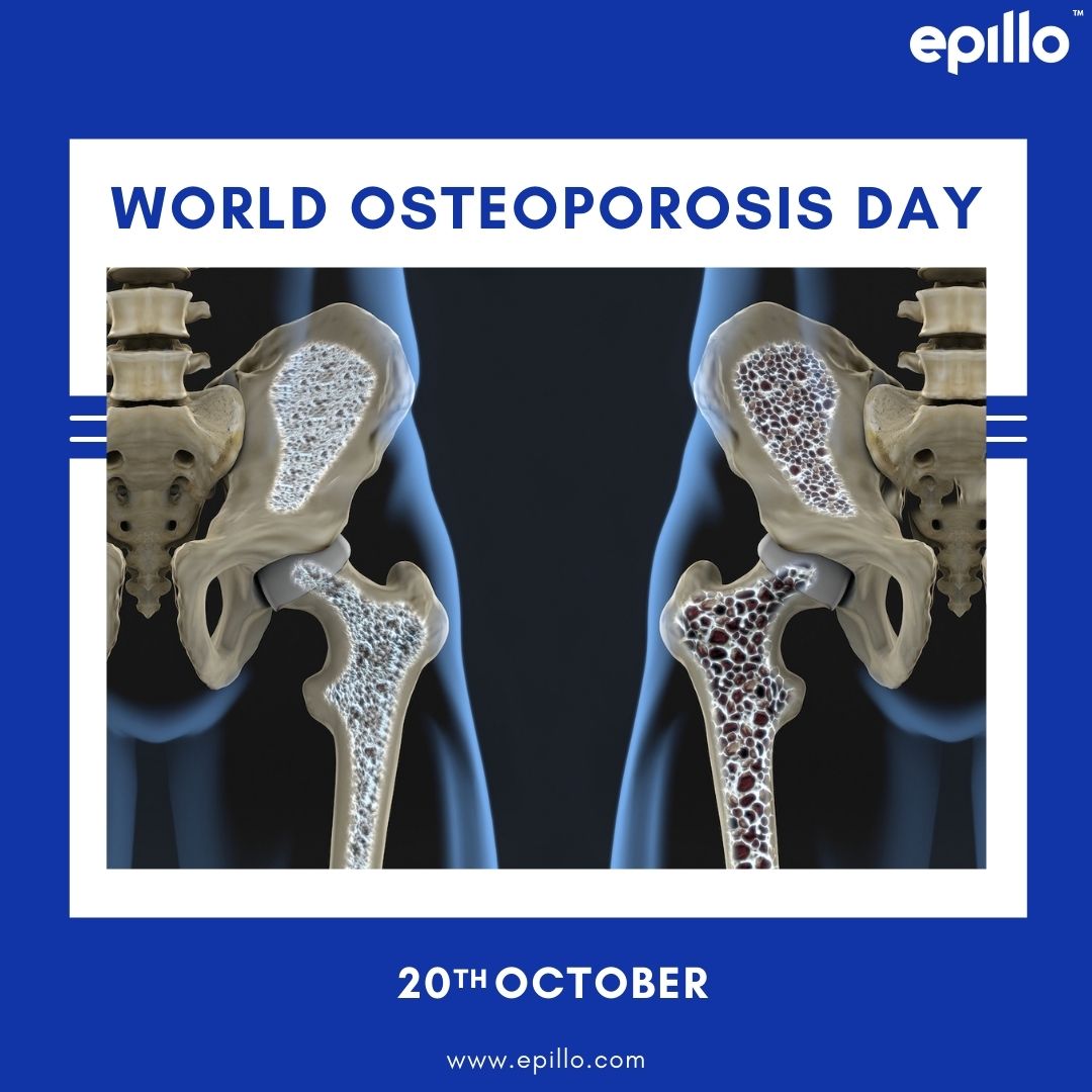 Epillo Health Systems tweet media