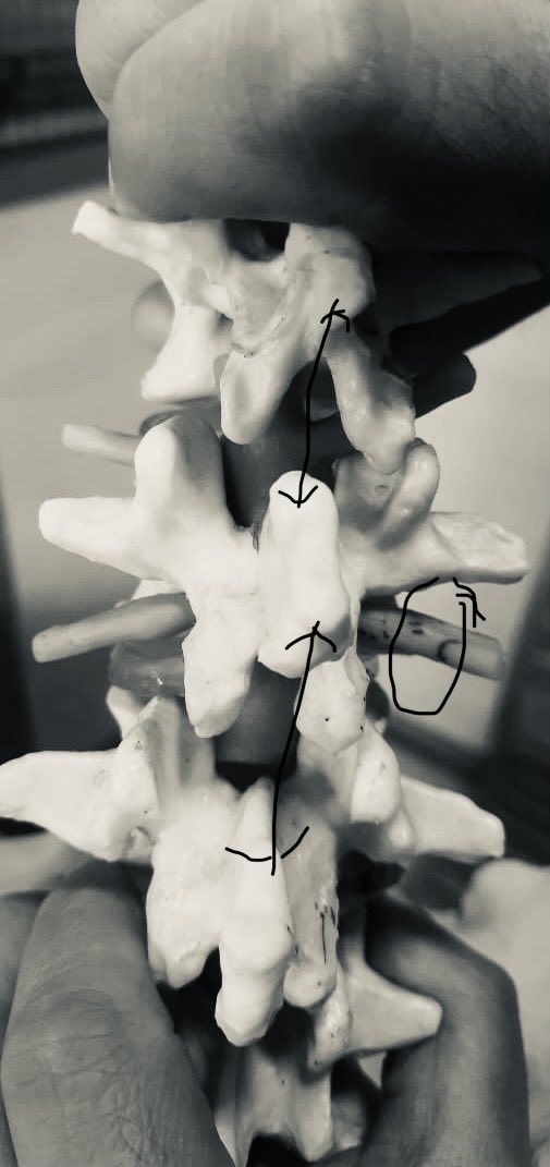 tariqtramboo's tweet photo. You want to walk straight & pain free in old age? Bow down regularly as during Salah, in young age. Regular bowing, decreases the pressure on spinal nerves as shown in image 2. & may not allow LF to get hypertrophied. People from other faiths to do flexion exercises. #Spineloop https://t.co/34PtaoGbGg