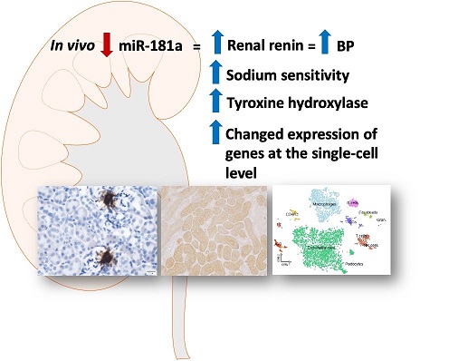 HyperAHA's tweet photo. This study led by @FZMarques and @GeoffreyHead combines a new #CRISPR_Cas9 model #RNAScope @ACDbio and #scRNA_seq technology with traditional techniques such as telemetry and #renin #IHC to describe how #miR181a regulates #BloodPressure #MicroRNA #SSBP. https://t.co/AmjN6duS2C https://t.co/jmCqTDgiVI