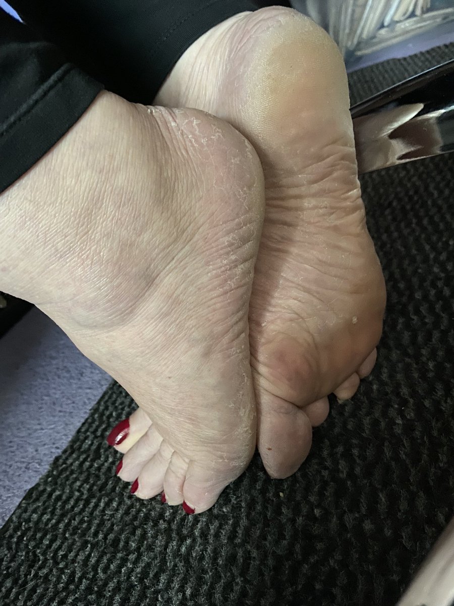 JJFeet3's tweet photo. Someone has been under my work desk😲
More on my https://t.co/XIQ1o1Ez5Q
#barefeet #hardfeet #dirtyfeet #maturefeet #bbwfeet #feetlicking #redtoes #soles #feetfetish https://t.co/2udfWMV0Fi