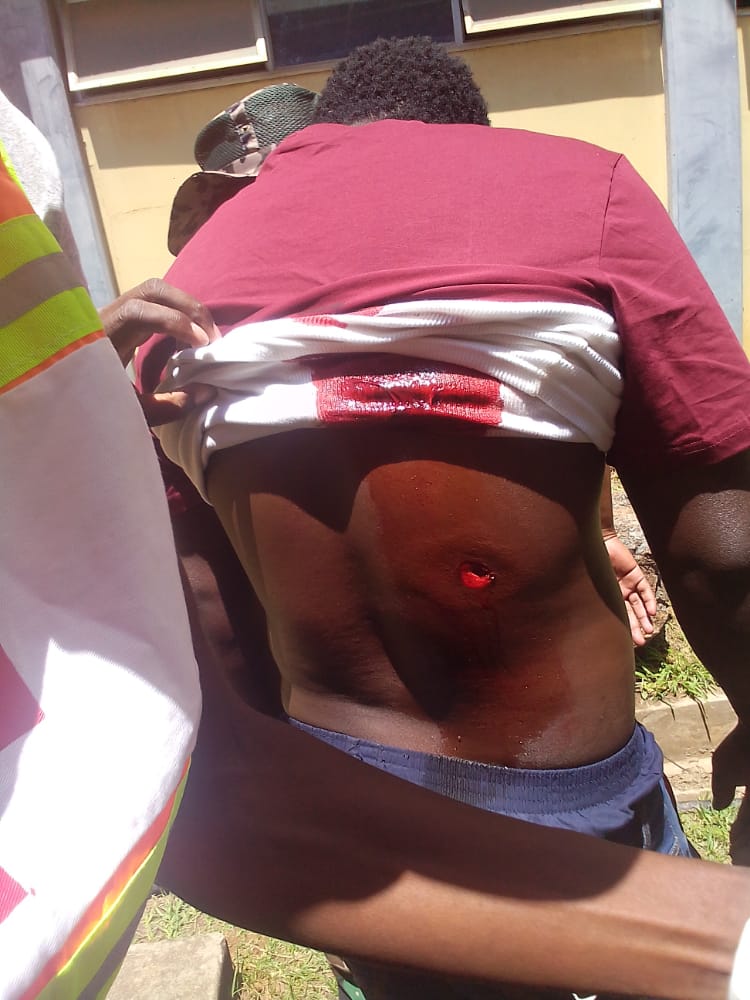 Happening today, Police use live round to shoot innocent Swazis who are unarmed. The internet has been shut down to avoid today's pictures from reaching the world. 
#EswatiniProtests