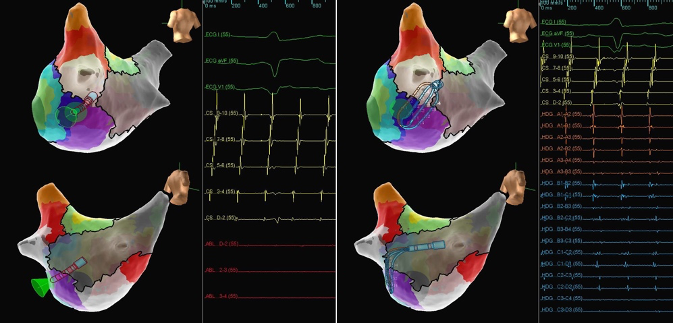 AbbottCardio tweet picture