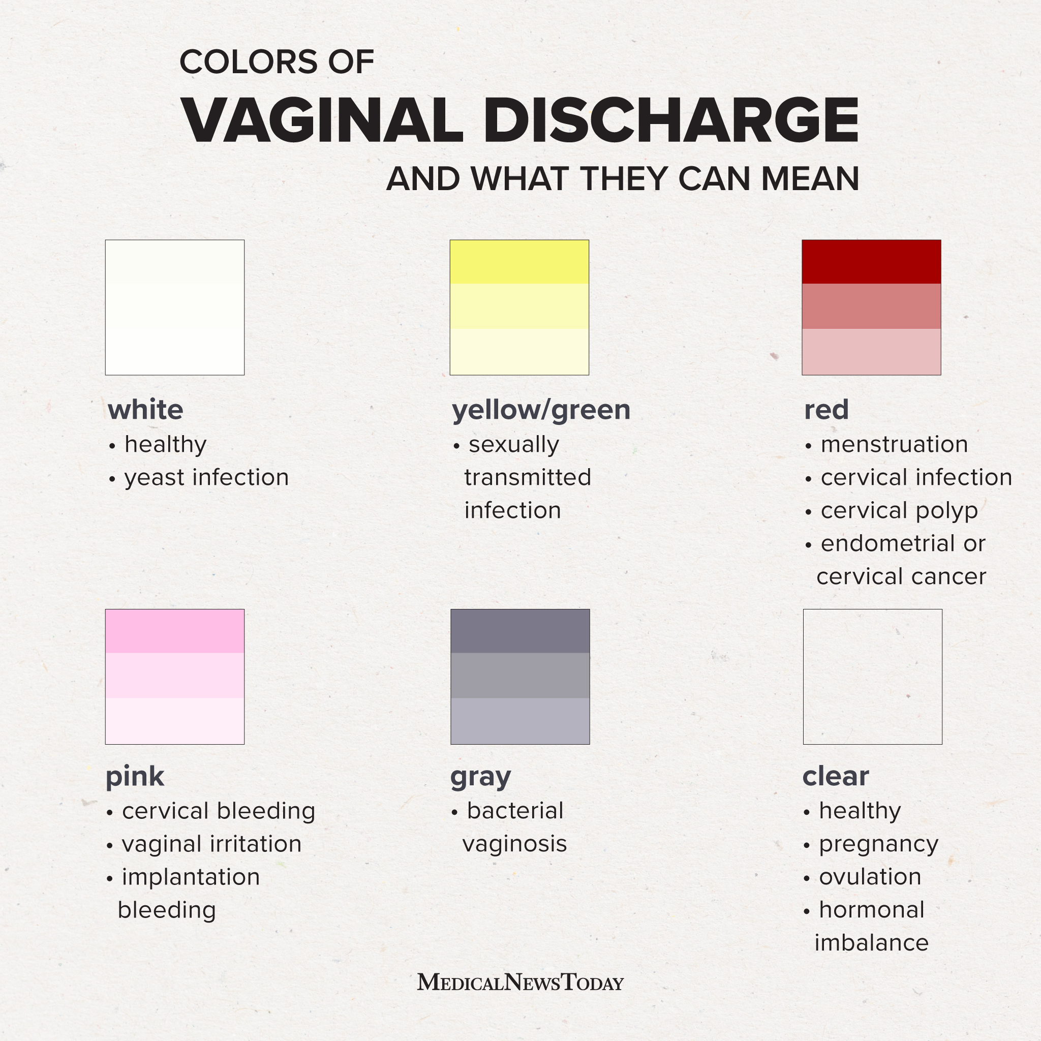 Discharge Colors Vaginal Discharge Types And What They 49 Off