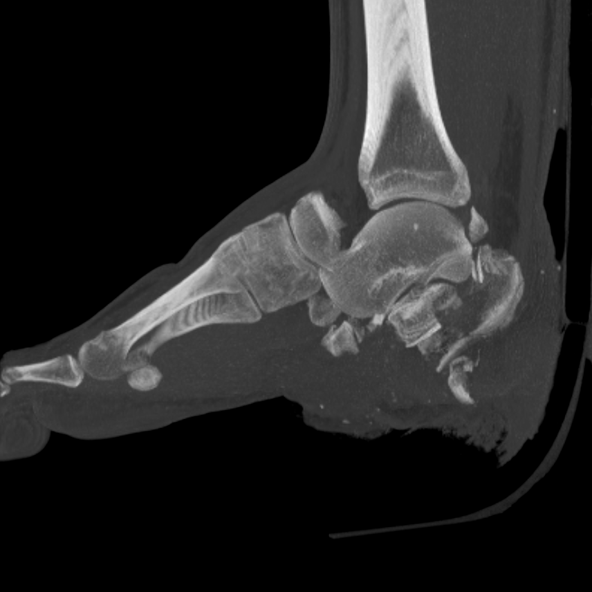 traumaticum's tweet photo. I'll just leave this here #orthotwitter https://t.co/8xoKgkH5Fu