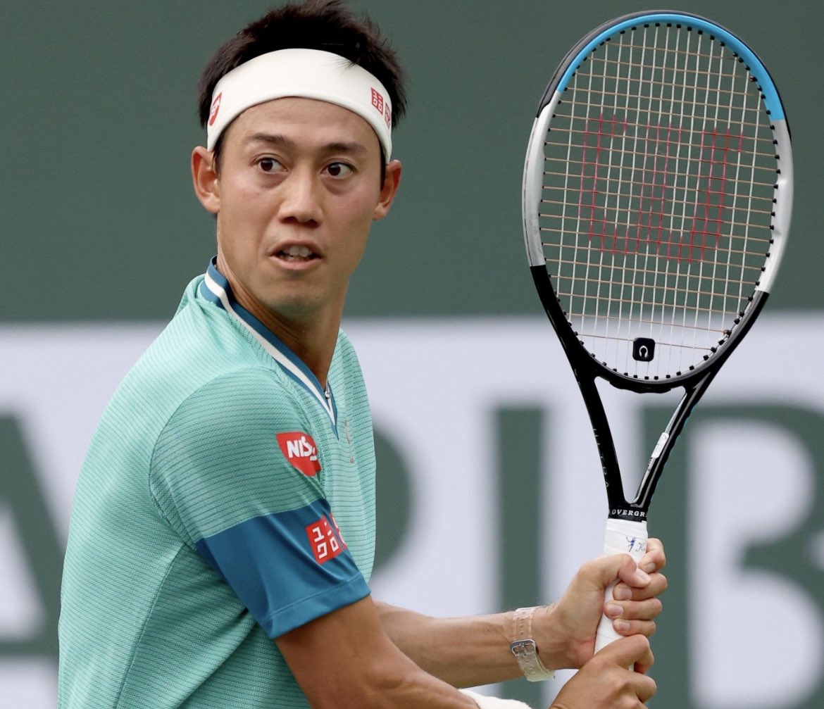 prsttennis2's tweet photo. 錦織選手の最近のラケットを見るとヨークのグロメットの色が青の時と黒の時がありますね。

何か区別している��かしていないのか。

黒だともはやクラッシュゾーンを騙す気は無いよう。 https://t.co/yu5D35ssM4