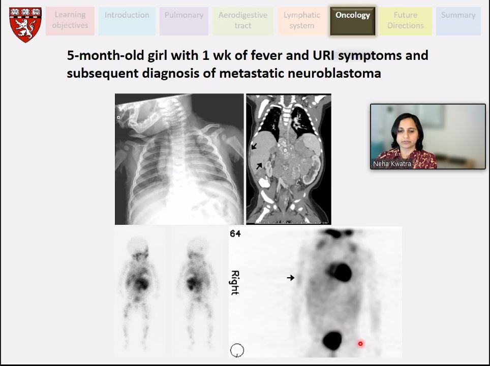 What a fabulous MIC talk with @nkrad! Can't believe how much I learned!! Stayed tuned next month for the incredible Dr. Mei Mei Chow speaking about ambiguous genitalia. @boschildrensrad @SocPedRad @WorldFederation #womeninradiology #ImagingOurFuture @CHOPRadiology @CincyKidsRad