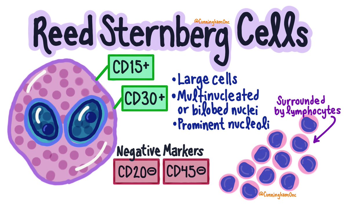 Danielle A. Cunningham, MD (@cunninghamonc) on Twitter photo Thank you <a href="/HoppeBrad/">Bradford Hoppe</a> for your incredible talk on the management of Hodgkin lymphoma today, and for requesting the creation of this graphic on Reed Sternberg cells! #HodgkinLymphoma #hemonc #pedonc #radonc #roedu
CC:
<a href="/Bloodman/">Bloodman</a> <a href="/AaronGoodman33/">Aaron Goodman - “Papa Heme”</a> <a href="/ETSshow/">Mark Shapiro, MD</a> <a href="/acweyand/">Shematologist, MD</a> Thank you <a href="/HoppeBrad/">Bradford Hoppe</a> for your incredible talk on the management of Hodgkin lymphoma today, and for requesting the creation of this graphic on Reed Sternberg cells! #HodgkinLymphoma #hemonc #pedonc #radonc #roedu
CC:
<a href="/Bloodman/">Bloodman</a> <a href="/AaronGoodman33/">Aaron Goodman - “Papa Heme”</a> <a href="/ETSshow/">Mark Shapiro, MD</a> <a href="/acweyand/">Shematologist, MD</a>