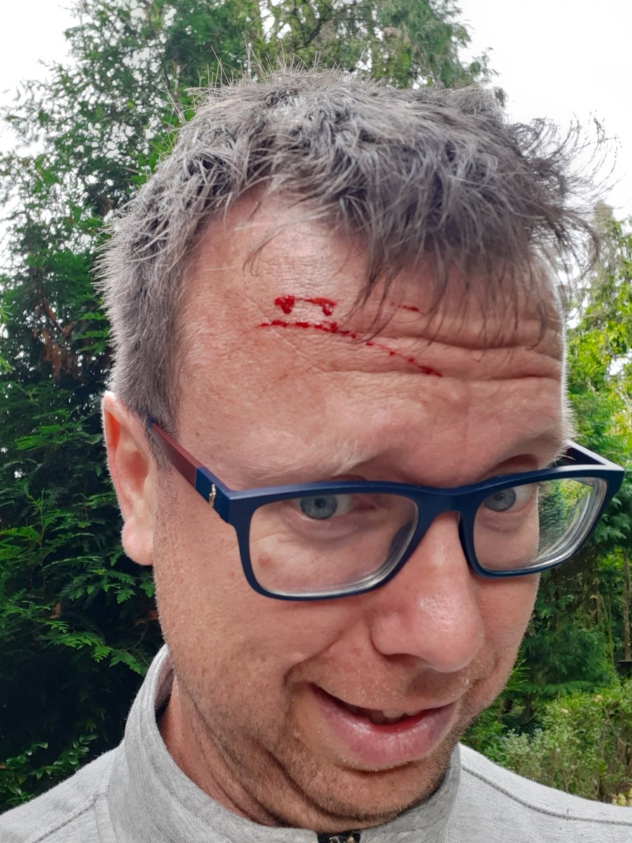 Vandaag is rood....de kleur van mijn voorhoofd....en de bomen natuurlijk ook.
Tijdens de monumentale bomeninspectie in 020 te grazen genomen door een boom (Osagedoorn). #bomenbieb