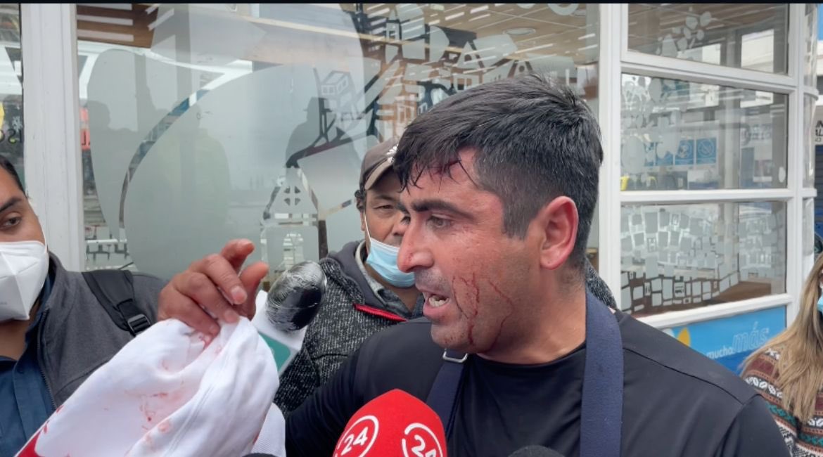 AgenciaQuinta's tweet photo. 🔴Pescadores heridos con balines disparados por La Armada en Valparaíso.
#manifestaciones #protestaschile #protestas #protestaspescadores #pescadoresheridos #laarmada https://t.co/R6C9pPfWLc
