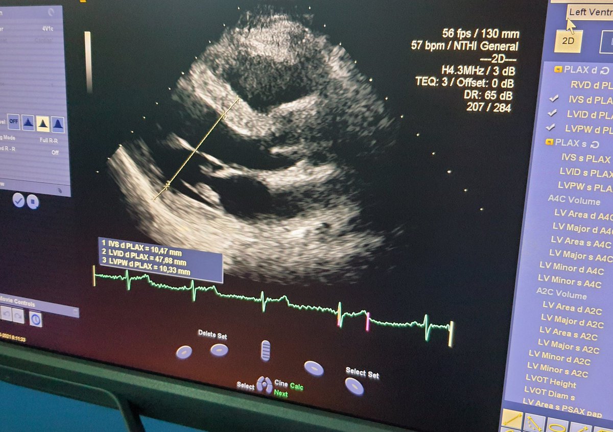 MarinaBersaoui's tweet photo. #MakingProgress #LearnNewSkill #CardiacFunction #PostExercise #BloodPressure #RegulatingMechanisms #Ethnicity #PhDResearch https://t.co/mRc3xxdbUN