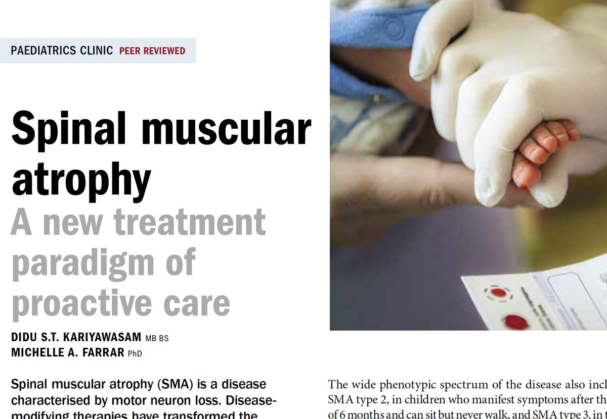 Medicine Today (@medtodayjournal) on Twitter photo Spinal muscular atrophy is characterised by muscle weakness from denervation of spinal and bulbar motor neurons. Read more... from Prof Farrar <a href="/imichellefarrar/">michelle farrar</a> and Dr Kariyawasam.
zcu.io/gn41
<a href="/UNSWMedicine/">UNSW Medicine & Health</a> <a href="/kids_research/">Kids Research</a> #SMA Spinal muscular atrophy is characterised by muscle weakness from denervation of spinal and bulbar motor neurons. Read more... from Prof Farrar <a href="/imichellefarrar/">michelle farrar</a> and Dr Kariyawasam.
zcu.io/gn41
<a href="/UNSWMedicine/">UNSW Medicine & Health</a> <a href="/kids_research/">Kids Research</a> #SMA