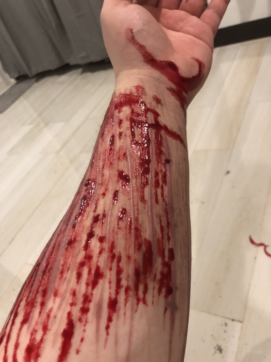 Bj29277's tweet photo. So much painful https://t.co/c1K555Tlmk