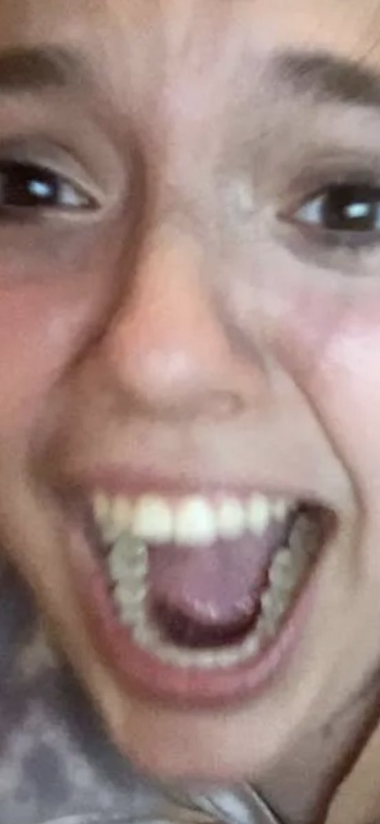 me when tiktok is down again #tiktokdown #TiktokDown