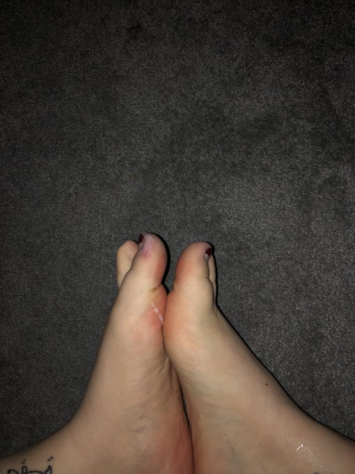 Someone come fix my toes😢 #feetdomination #feetworshi̇p #footgagging #Onlyfans_Girls #onlyfansman #onlyfansthick