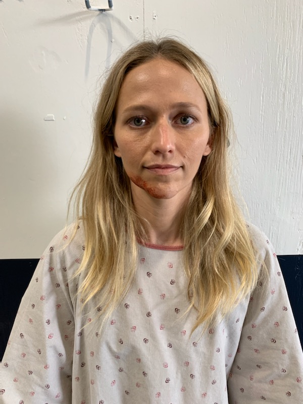 WolfEnt's tweet photo. Don't worry...actress @JohannaEBraddy was not injured in the making of tonight's #ChicagoMed! Here are some up close photos of the makeup work our team did to create her injuries! #OneChicago https://t.co/XGZlV13NcD