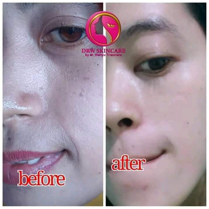 DrwLyn's tweet photo. Testi baru masih angettt😍🥰

Radiant Glow bisa juga atasi flek hitam mu loh, bonusnya pori2 makin halusss🤭
Varian baru Radiant emg sekeren itu sih🥳 https://t.co/kLtIMoa47t