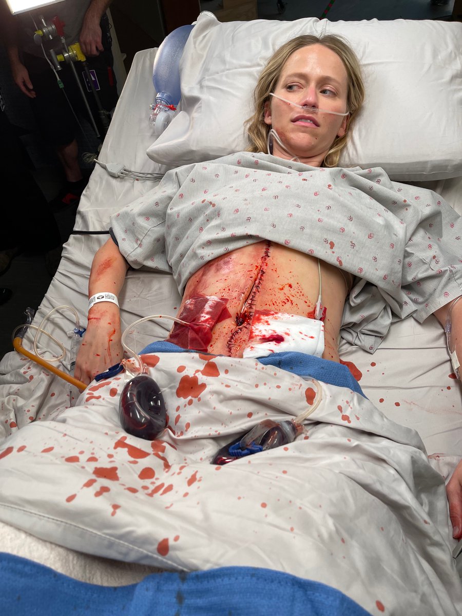 WolfEnt's tweet photo. Ever wonder how we cut open our actors? To create tonight's incision scene, our #ChicagoMed SPFX Makeup team created a silicone belly piece to overlay onto the actor and rigged it with a blood tube from Special FX! #OneChicago https://t.co/4ymPkRQWTo