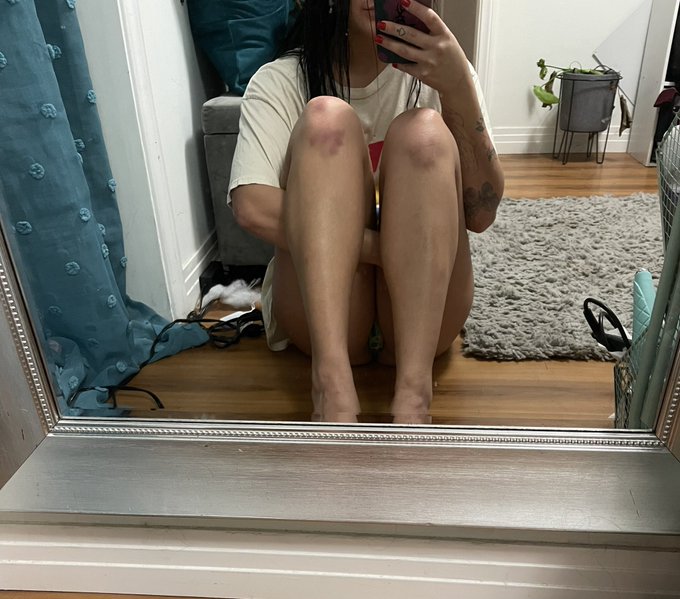 wild guess anyone know what i did the past 2 days rip to my ankles and knees https://t.co/xLDCzxf9F5
