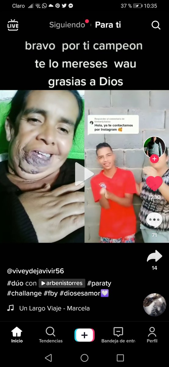 Laly3120's tweet photo. Hola, 😍 yo se que no tengo muchos seguidores, pero necesito que compartan esto, esta señora conmueve mi corazón ya que necesita ayuda porque está grabe de su boca, me ayudan a que llegue esto a nuestra Reyna  @KimberlyLoaiza_, @SAFEPLACEKL https://t.co/EoacG9mGkS