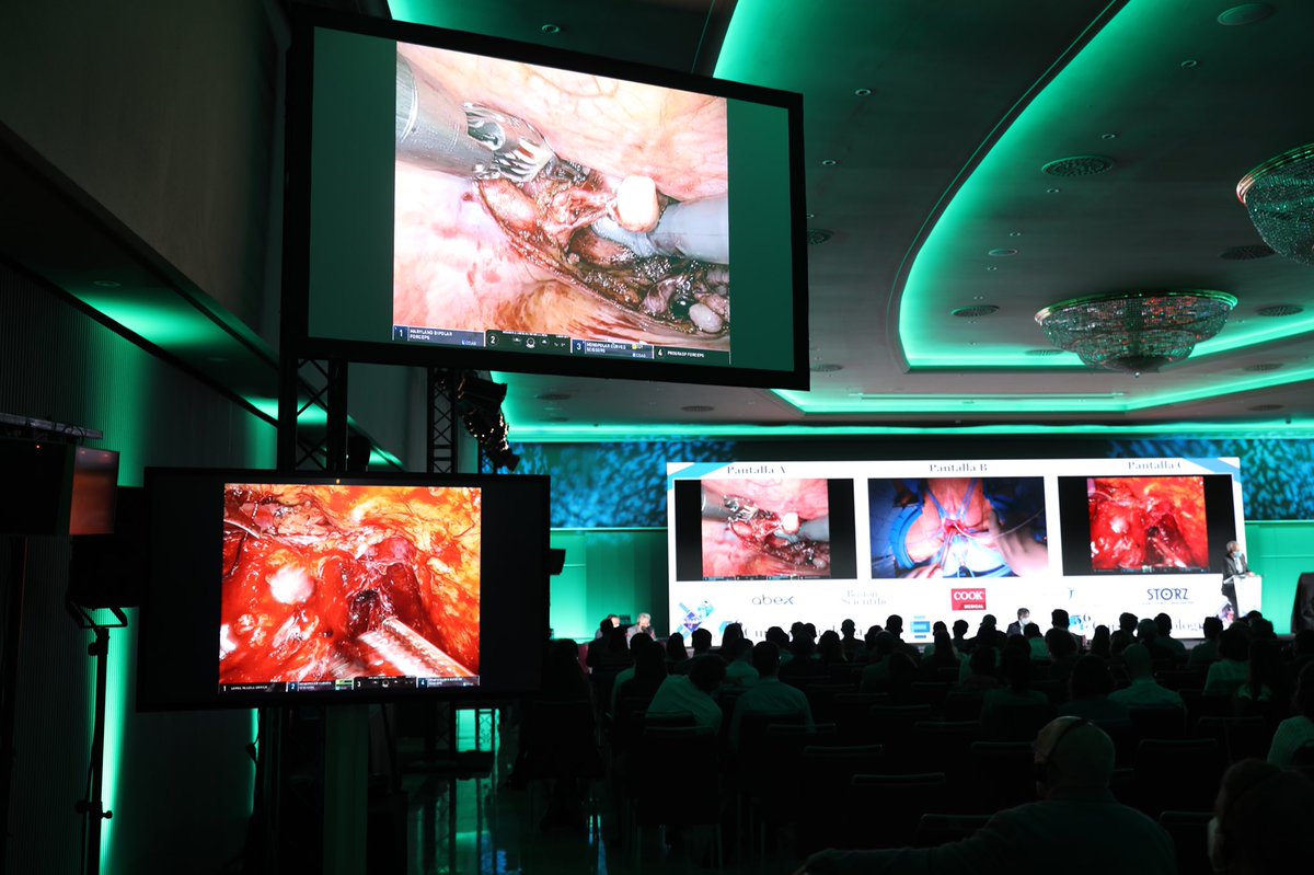 El Dr. <a href="/bernardorocco73/">Bernardo Rocco, MD,FRCS (Glasgow)</a> realiza una prostatectomía radical robótica con endomicroscopia en directo.

#56UroPuigvert