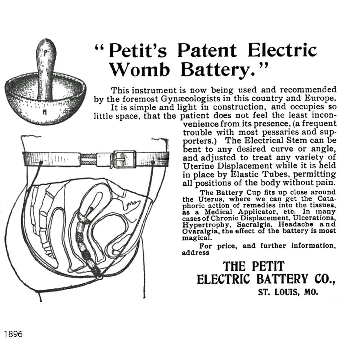 The late nineteenth century saw the invention of the ‘womb battery’. It’s a battery that is inserted in the cervix. It was for the ‘treatment of the diseases peculiar to women.’