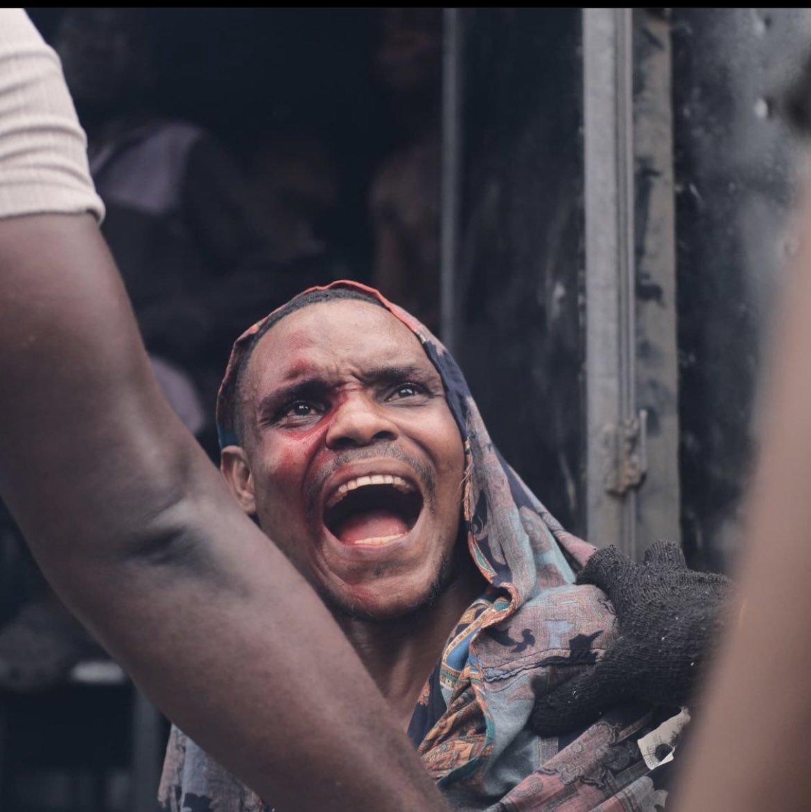 gbengaajiboy's tweet photo. Clement Adedotun, an uber driver, assaulted after being falsely accused of being a hoodlum. 

Nigeria happened to him via Nigeria Police Force.

#EndSARS #SquidGame #EndSARSMemorial #LekkiMassacre2020 #LekkiTollGate #EndSARSHelp #EndPoliceBrutality #EndBadGovernanceinNIGERIA https://t.co/SPRj1nDmA1