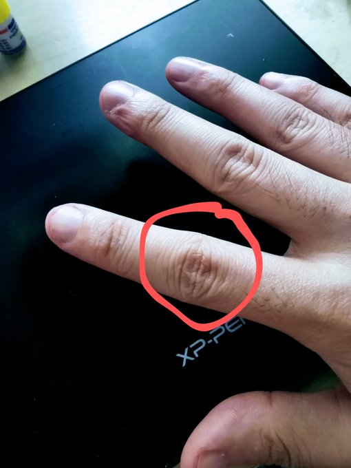 ทำงานจนปวดข้อนิ้วตรงนี้​ ;w;)
งอแล้วดังกร๊อบแกร๊บ 