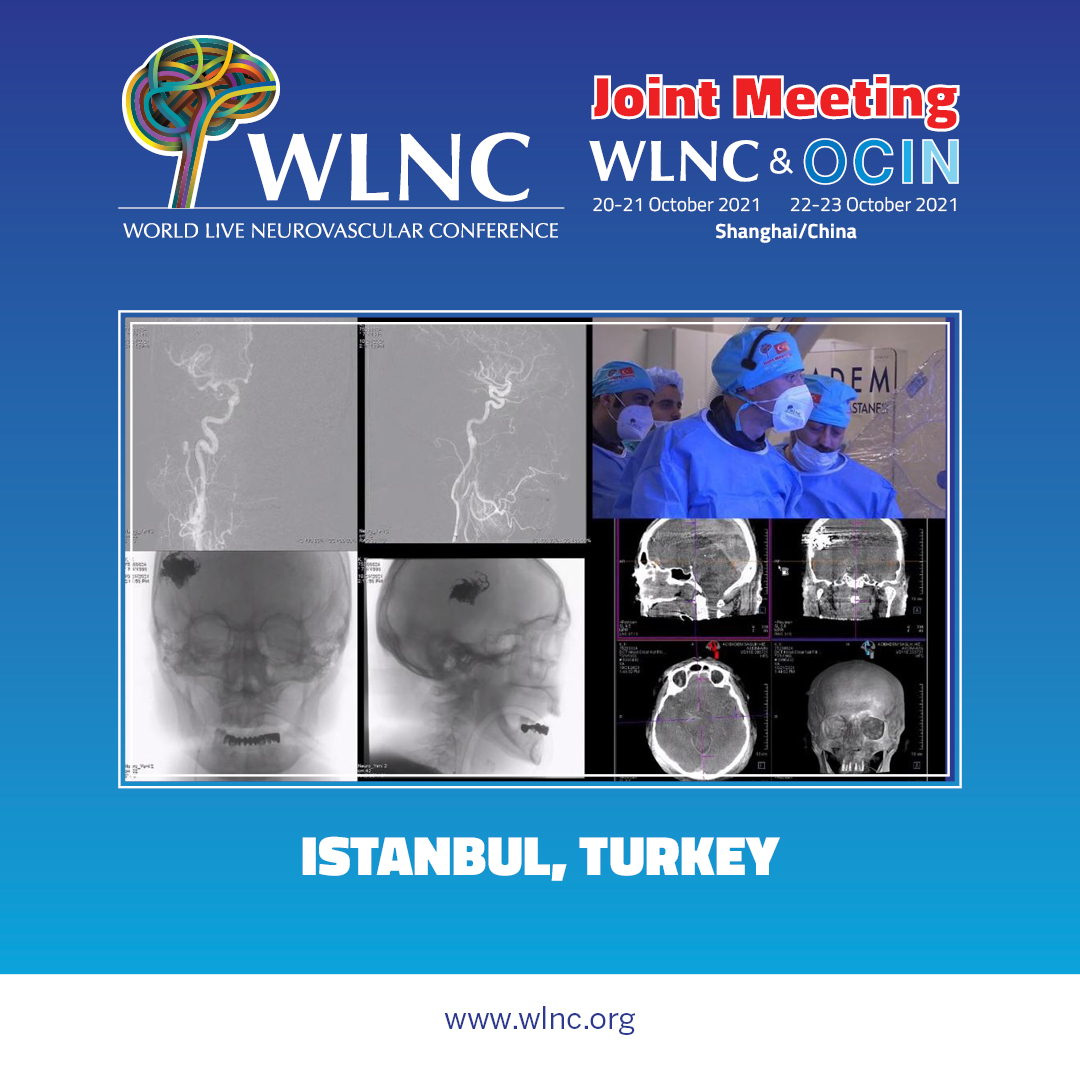 WLNCofficial's tweet photo. 🎉Here we are at the second day of WLNC- OCIN Joint Meeting 2021 with over 19.5k participants...
Thank you for your valuable attendance and see you tomorrow with new live cases from China 🇨🇳 & Turkey 🇹🇷
#wlnc #livecase #ocin #aneurysm #neurovascular #neurosurgery #dekoncongress https://t.co/u2rvOYsNmr
