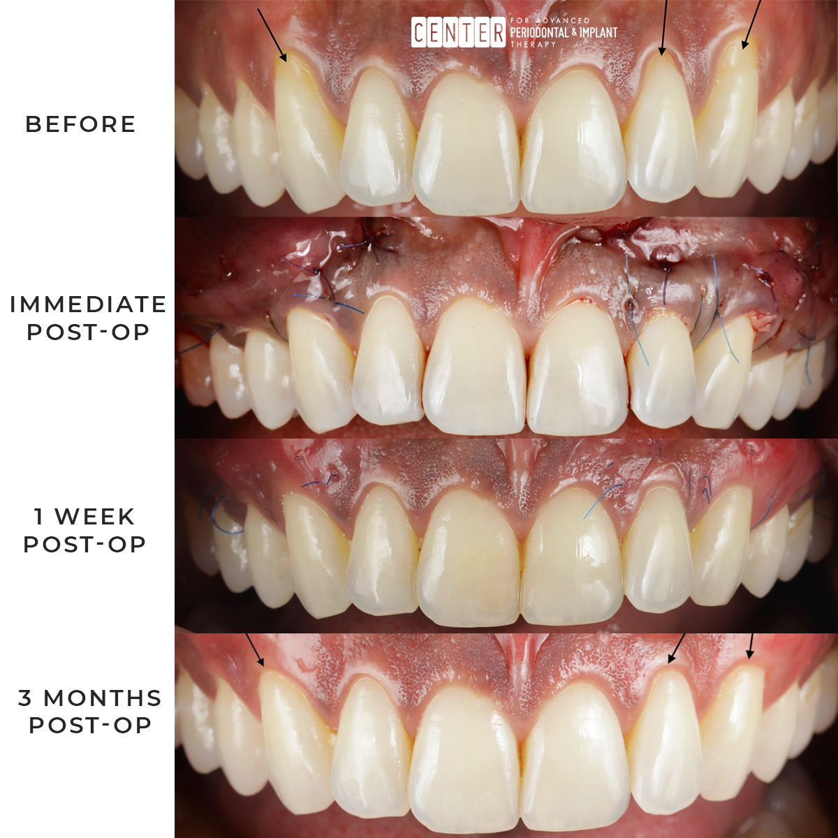 CENTER for Advanced Periodontal & Implant Therapy tweet media