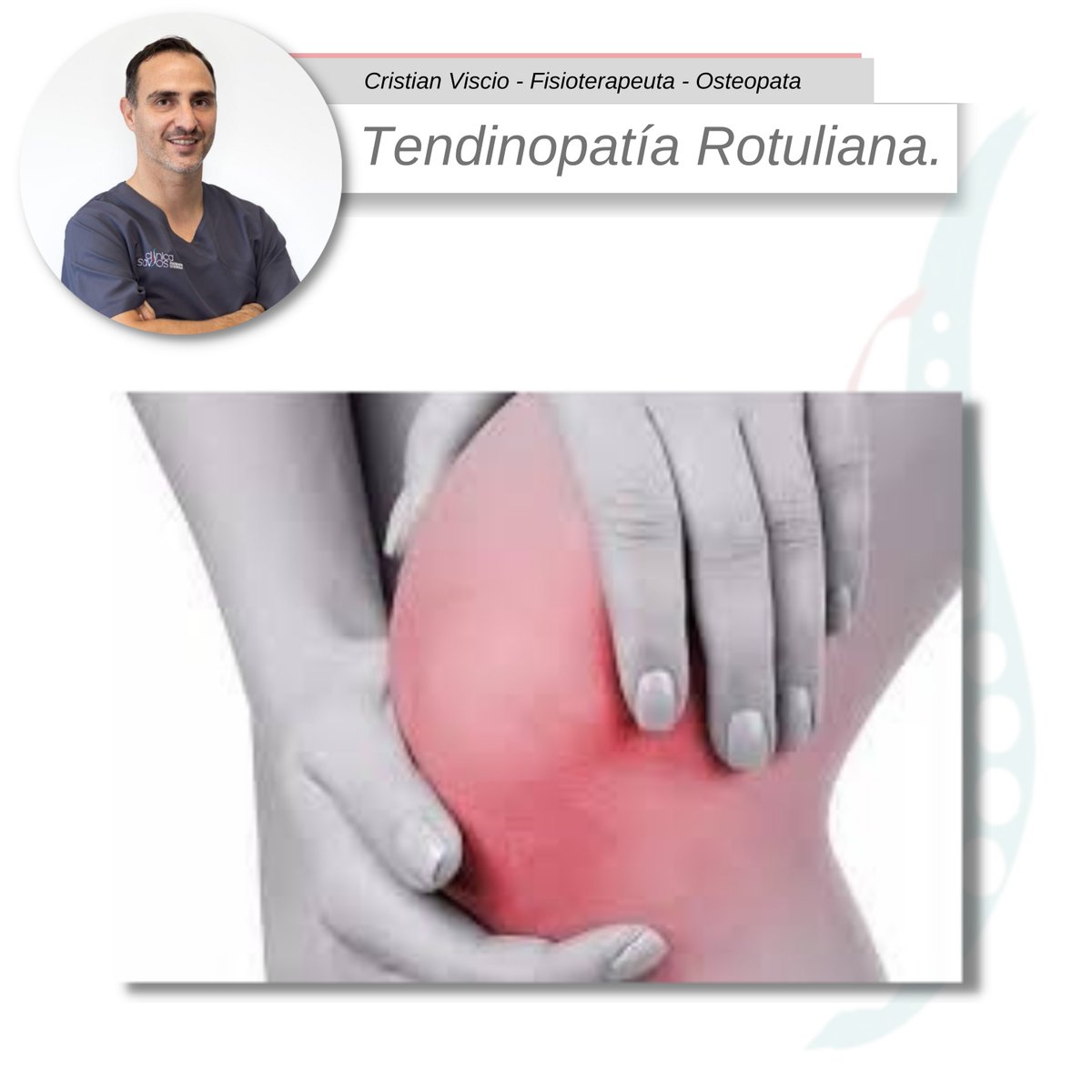Hola! 👋

Hoy, nuestro profesional Cristian Viscio nos hablará un poco acerca de la tendinopatía rotuliana:

Mas información en: instagram.com/clinicasavios/…