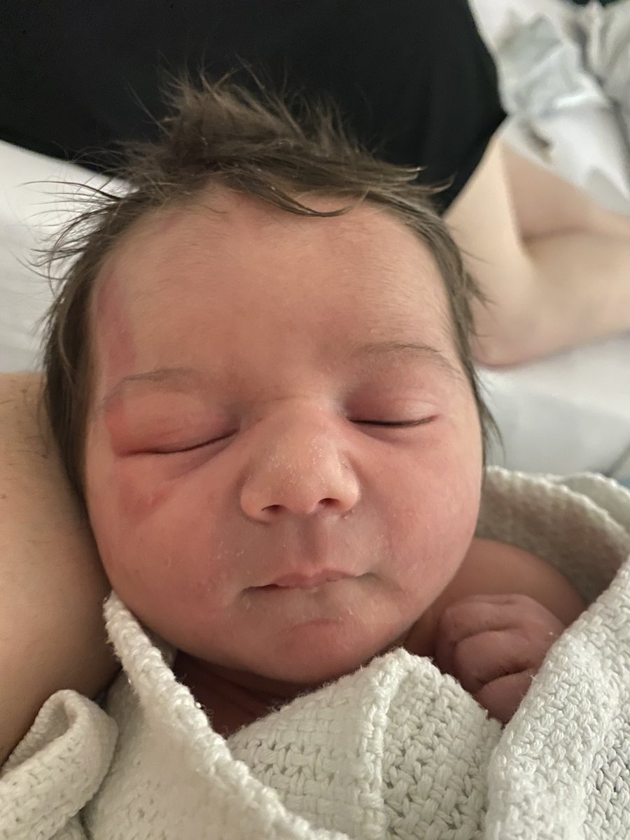 liamjblizard's tweet photo. Spent my entire 20’s and 30’s resolutely saying NOPE to children, but now she’s here, I’ve never wanted anything more in my life.

Robin Ginevra Blizard Annand. https://t.co/QYQNPDnlxU