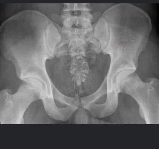 Har du interesse for billeddiagnostik? Så kom og bliv vores nye kollega😁 rm.emply.net/recruitment/va…
