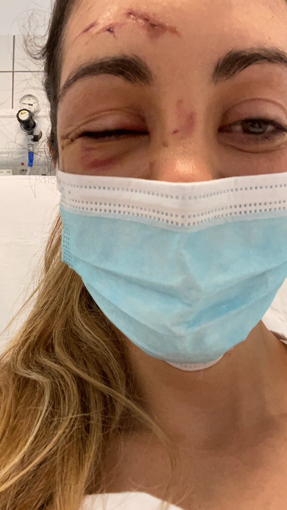 soniscs's tweet photo. Hace tres semanas tuve un accidente con la bici y me dí un golpe en la cabeza. Me hicieron un TAC de urgencias y cuando el médico vino para darme los resultados me dijo: “no se ven lesiones traumáticas agudas, però te hemos encontrado un pequeño tumor”.👇🏼 https://t.co/wqbvkcrWVc