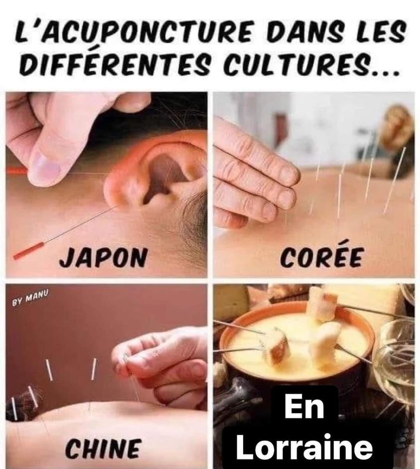 GARREAU75's tweet photo. l'#acuponcture selon les #cultures 😇😂 https://t.co/K6qcdo0TB2