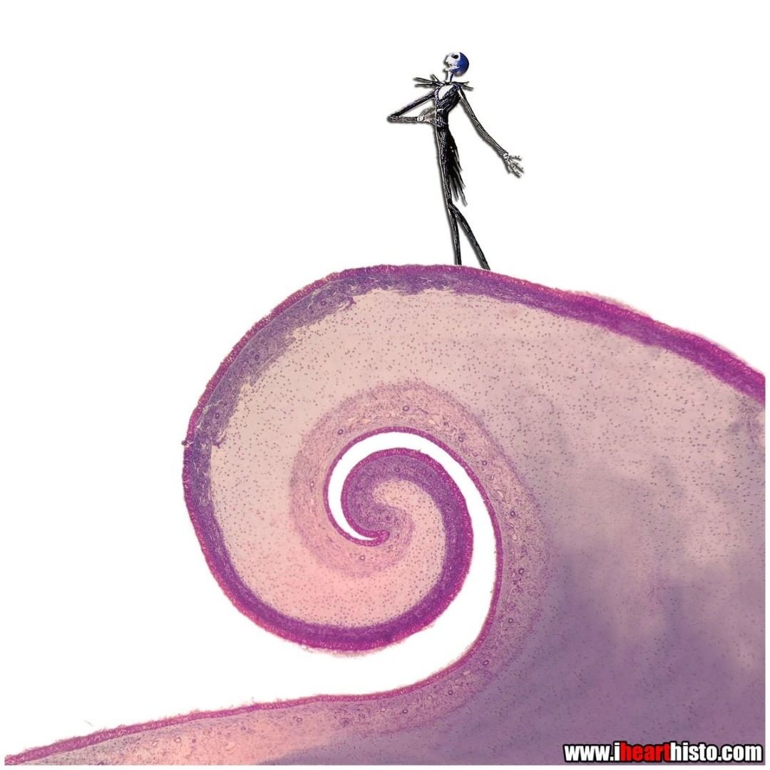 IHeartHisto's tweet photo. 🎃 The Nightmare Before Concha 💀

What’s this?
What’s this?

It's a nasal concha

i💀histo

#histology #anatomy #pathology #pathologists #halloween https://t.co/rBKQnDbHWz